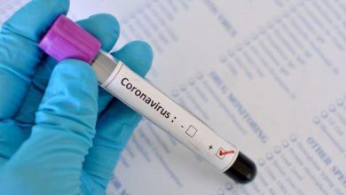 Photo of Confira o perfil dos casos de coronavírus em Conquista