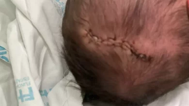 Photo of Bebê tem traumatismo craniano ao cair durante parto em maternidade em BH