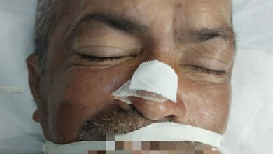 Photo of Conquista: Hospital Geral busca familiares de paciente inconsciente