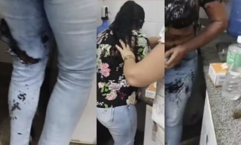 Photo of Mulher vai parar na delegacia após jogar soda cáustica em funcionária de posto de saúde